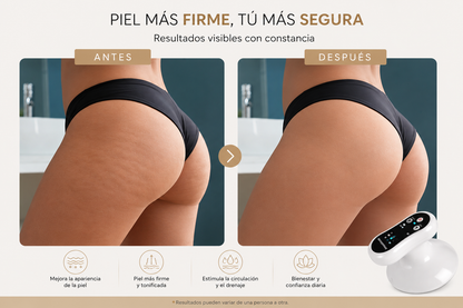 Masajeador Anticelulítico Recargable por Succión y Calor